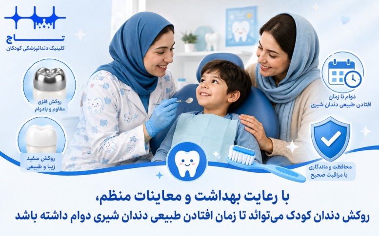 ماندگاری و افزایش طول عمر روکش دندان