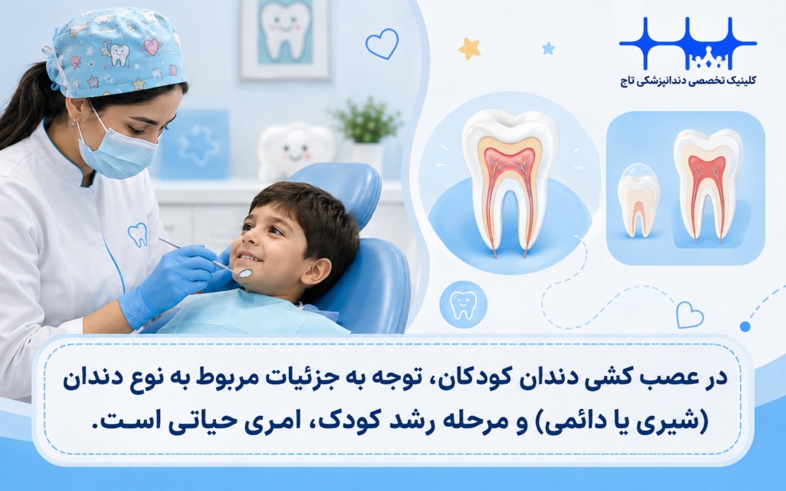 تفاوت عصب کشی دندان شیری و دائمی