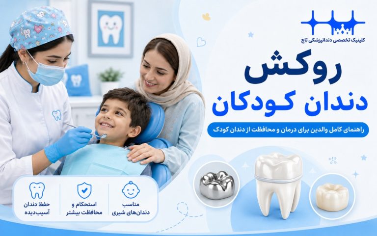 روکش دندان کودکان