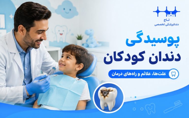پوسیدگی دندان کودکان